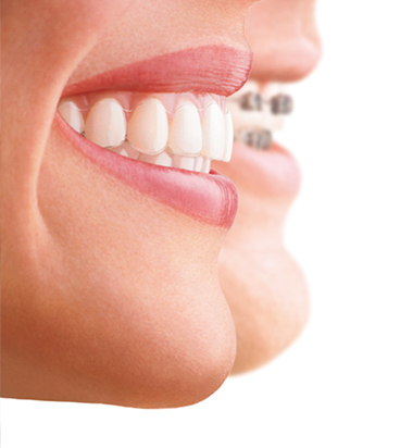 invisalign provider