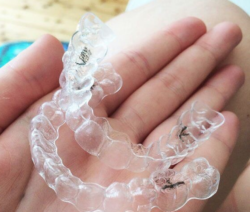 Fundas invisalign