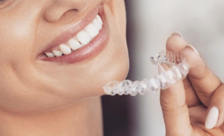 invisalign lite o full