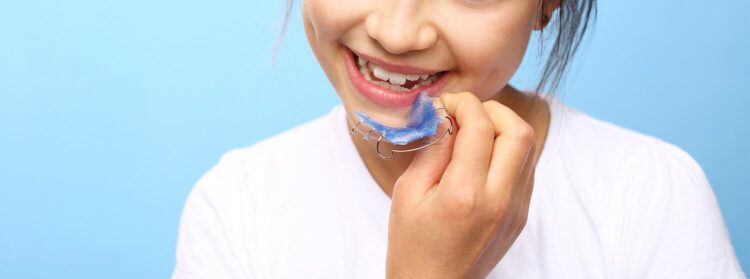 Aparatos de ortodoncia para niños