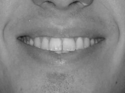 SONRISA 2 FINAL