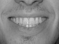 SONRISA 3