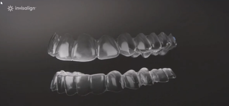 ¿Qué es Invisalign Moderate?